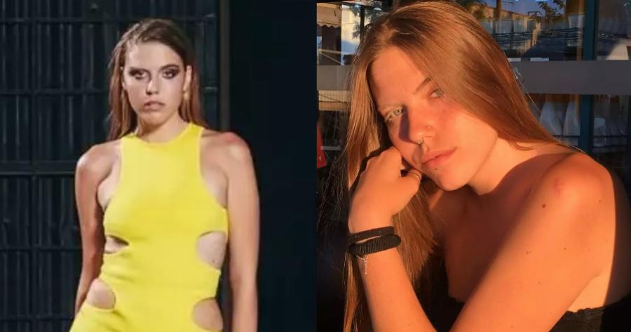 Ξετρελαίνει με τις φωτογραφίες και τη σπάνια ομορφιά της: Η Τζούλια Ιλιγένκο είναι το μοντέλο του GNTM με τη λεύκη