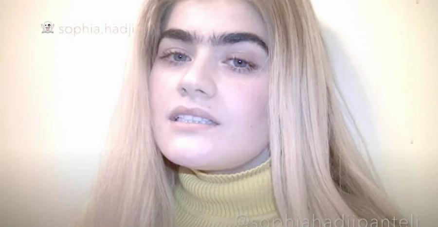 Χωρίς φουσκωμένα χείλη με άλλη μύτη και μικρό στήθος: Διέρρευσε φώτο της Χατζηπαντελή πριν τις πλαστικές