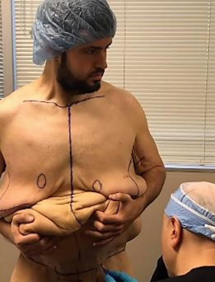 Σύγκλονίζει με τη ιστορία του: Άνδρας έβαλε στόχο, έχασε 140 κιλά, έγινε ένας κούκλος και παντρεύτηκε την παιδική του αγάπη