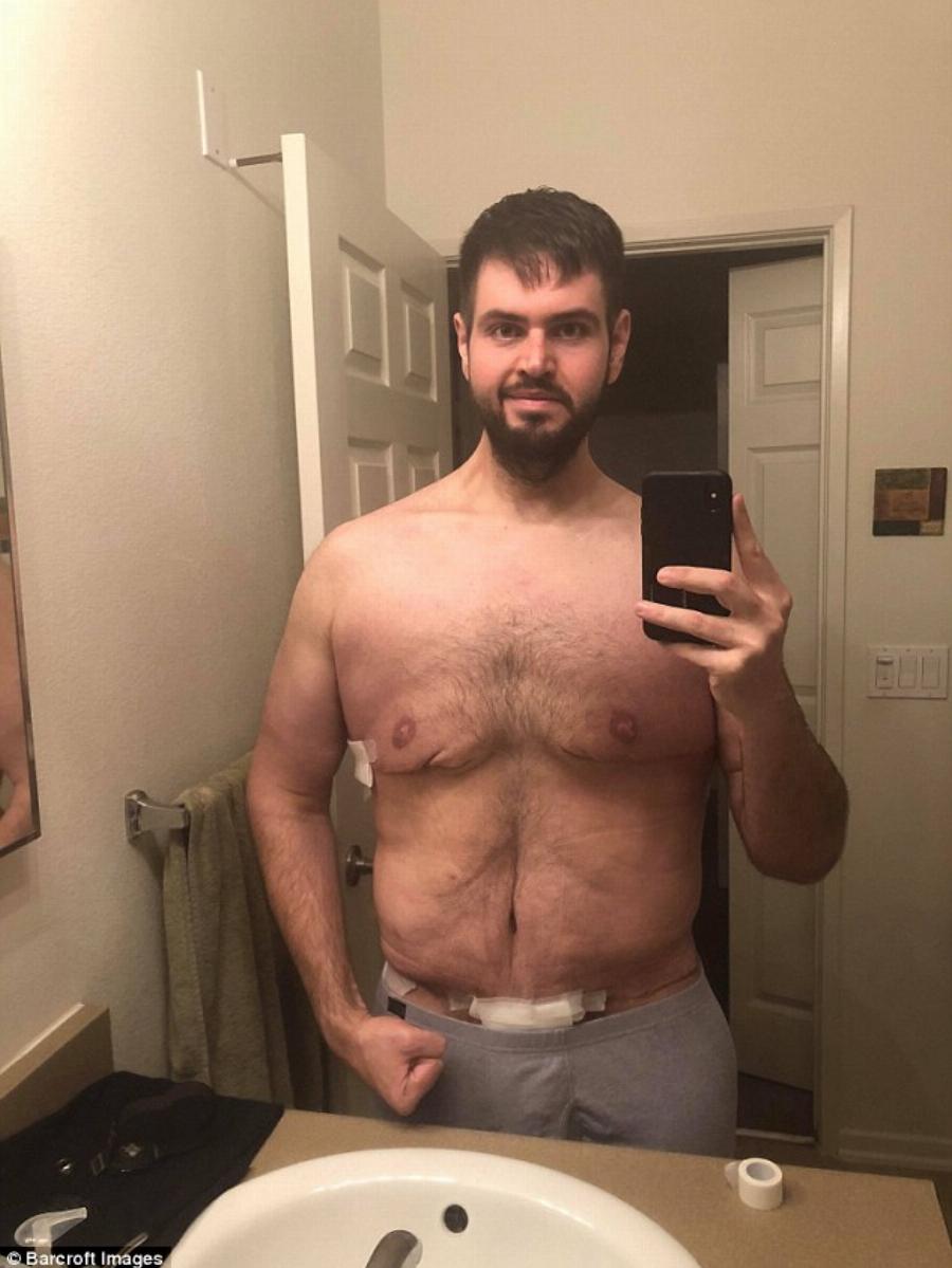 Σύγκλονίζει με τη ιστορία του: Άνδρας έβαλε στόχο, έχασε 140 κιλά, έγινε ένας κούκλος και παντρεύτηκε την παιδική του αγάπη