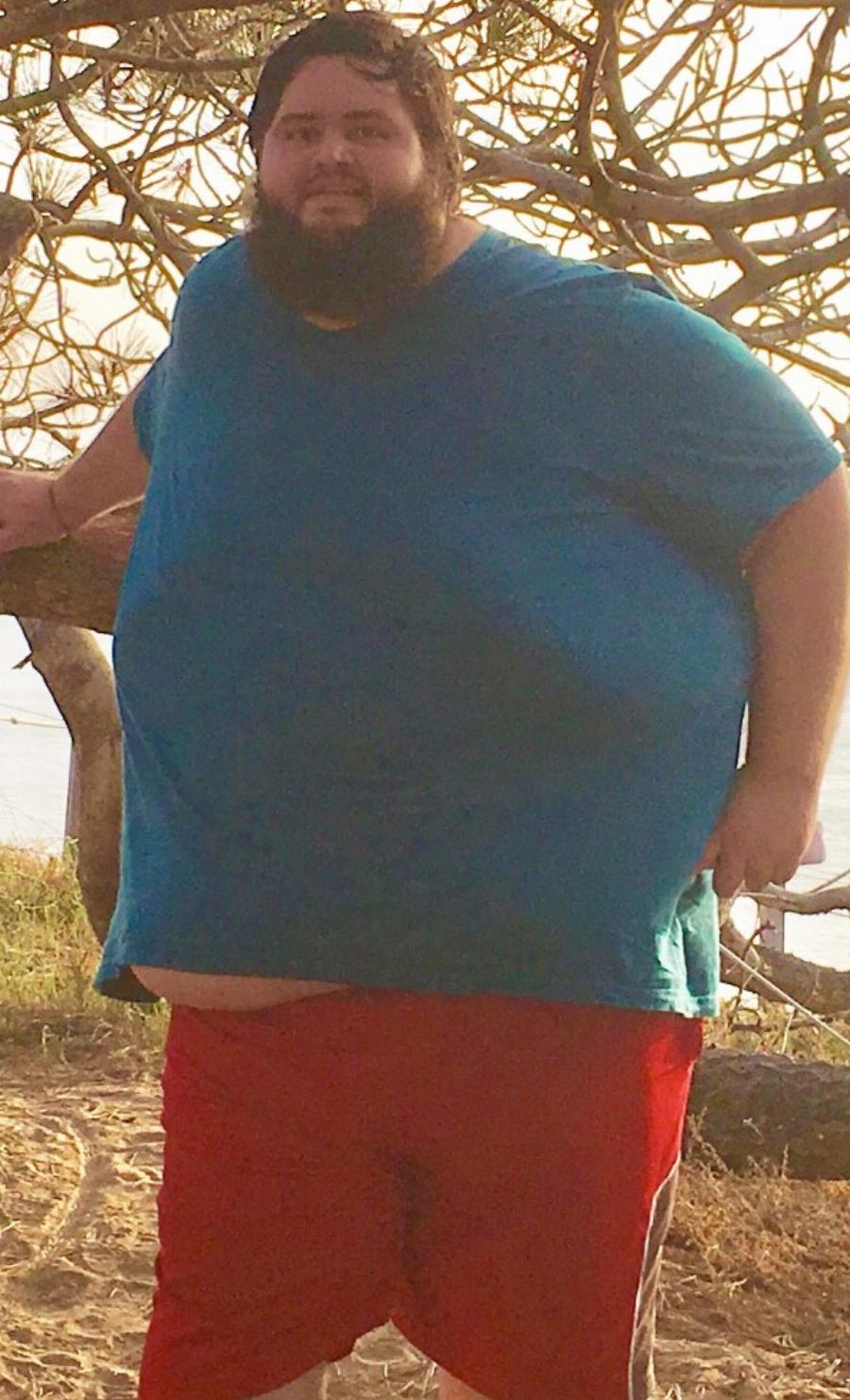 Σύγκλονίζει με τη ιστορία του: Άνδρας έβαλε στόχο, έχασε 140 κιλά, έγινε ένας κούκλος και παντρεύτηκε την παιδική του αγάπη