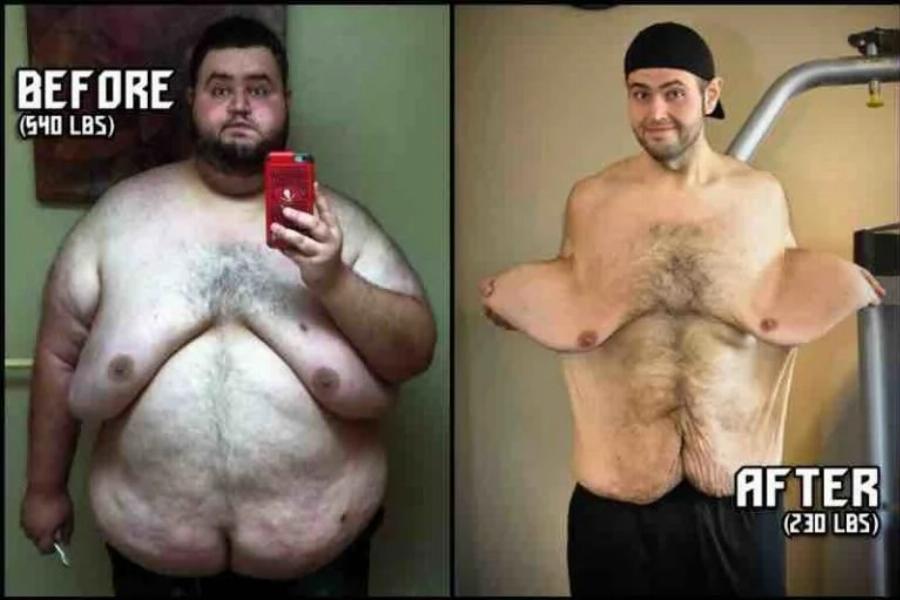 Σύγκλονίζει με τη ιστορία του: Άνδρας έβαλε στόχο, έχασε 140 κιλά, έγινε ένας κούκλος και παντρεύτηκε την παιδική του αγάπη