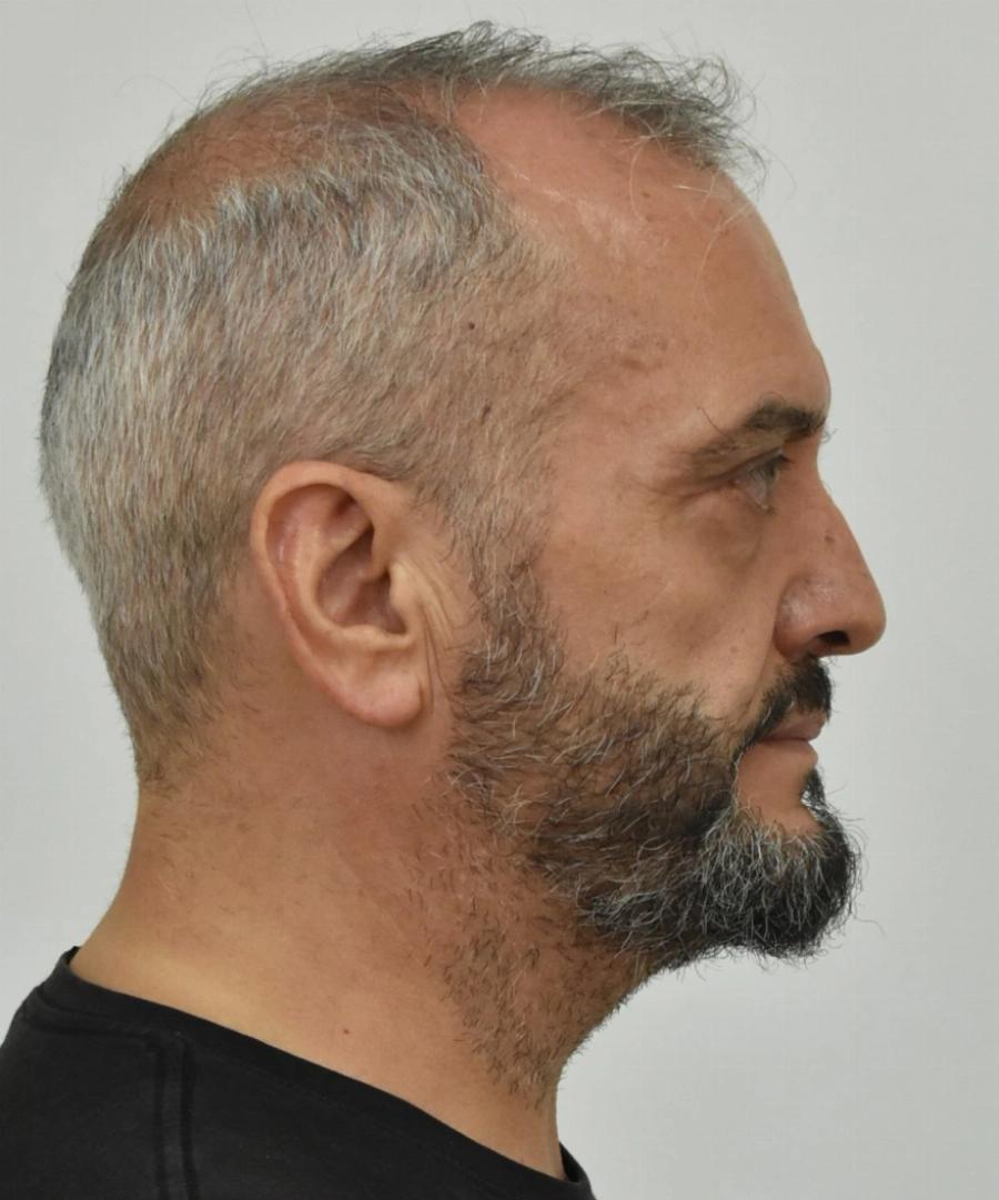 Δεν είναι μόνο αυτοί οι δύο: Έρχονται και τα υπόλοιπα ονόματα των βιαστών «πελατών» της 12χρονης μαθήτριας