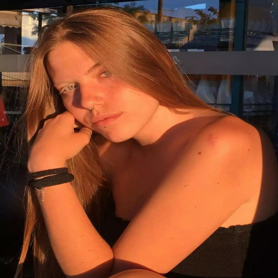 Ξετρελαίνει με τις φωτογραφίες και τη σπάνια ομορφιά της: Η Τζούλια Ιλιγένκο είναι το μοντέλο του GNTM με τη λεύκη