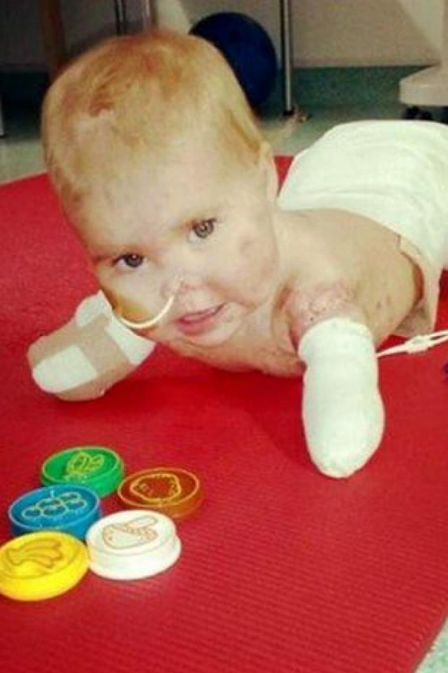 Συγκινεί η μικρή μαχήτρια: Δεν το έβαλε κάτω η 7χρονη που έχασε τα άκρα της από μηνιγγίτιδα, κατέκτησε χρυσό μετάλλιο στην ενόργανη