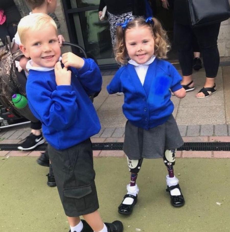 Συγκινεί η μικρή μαχήτρια: Δεν το έβαλε κάτω η 7χρονη που έχασε τα άκρα της από μηνιγγίτιδα, κατέκτησε χρυσό μετάλλιο στην ενόργανη