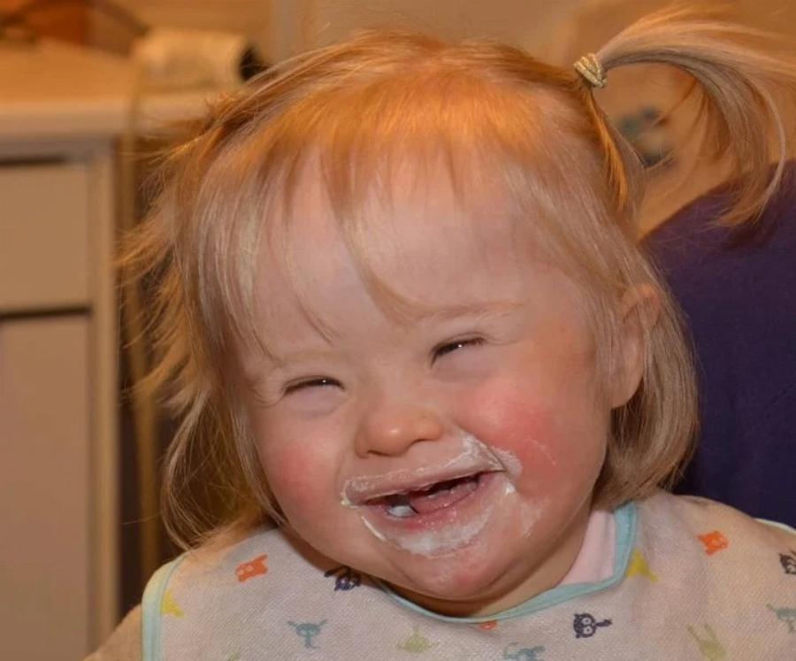 Συγκινεί η ιστορία ενός ανύπαντρου άνδρα που υιοθέτησε κοριτσάκι με σύνδρομο Down: 20 οικογένειες είχαν απορρίψει το παιδί