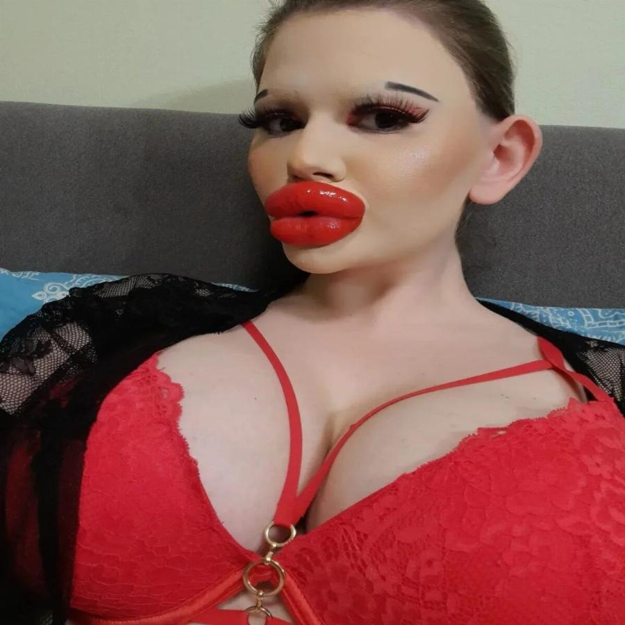 Ήθελε να μοιάζει με «κούκλα Barbie»: Από 19 ετών δεν έχει σταματήσει τις πλαστικές – «Πάντα γυρίζουν για να με κοιτάξουν»