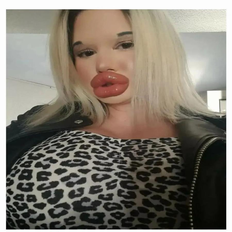 Ήθελε να μοιάζει με «κούκλα Barbie»: Από 19 ετών δεν έχει σταματήσει τις πλαστικές – «Πάντα γυρίζουν για να με κοιτάξουν»