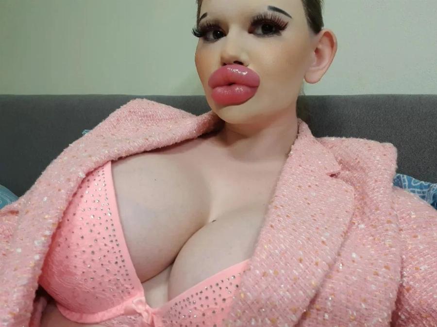 Ήθελε να μοιάζει με «κούκλα Barbie»: Από 19 ετών δεν έχει σταματήσει τις πλαστικές – «Πάντα γυρίζουν για να με κοιτάξουν»