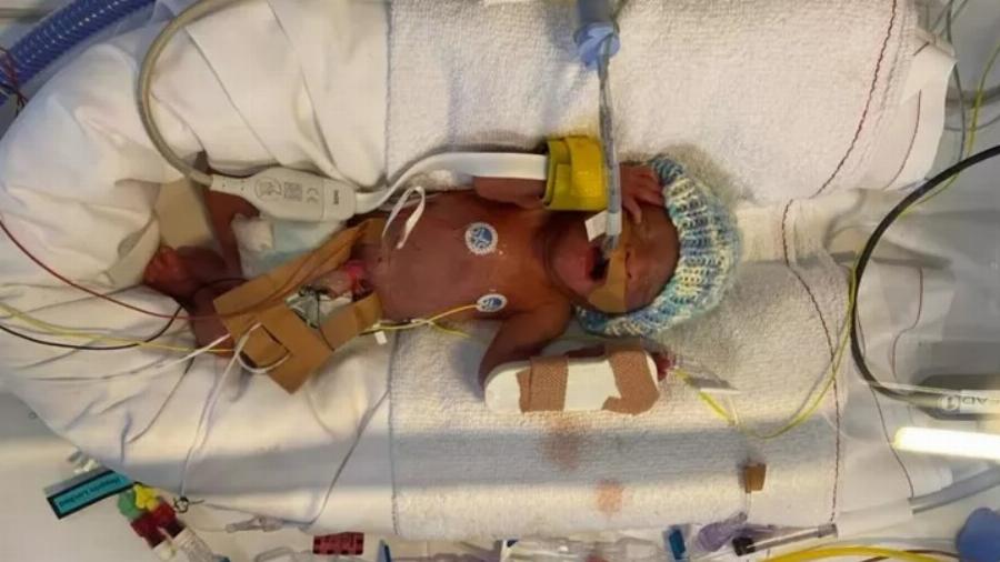 Αληθινή Ιστορία: «Μόνο εγώ πίστευα ότι το μικροσκοπικό προωράκι μου θα ζήσει και είχα δίκιο»