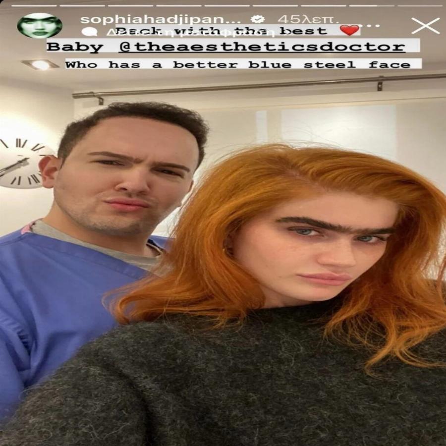 «Πείτε με “ψεύτικη” όσο θέλετε»: Η Σοφία Χατζηπαντελή ανέβασε φωτογραφίες μετά το μπότοξ