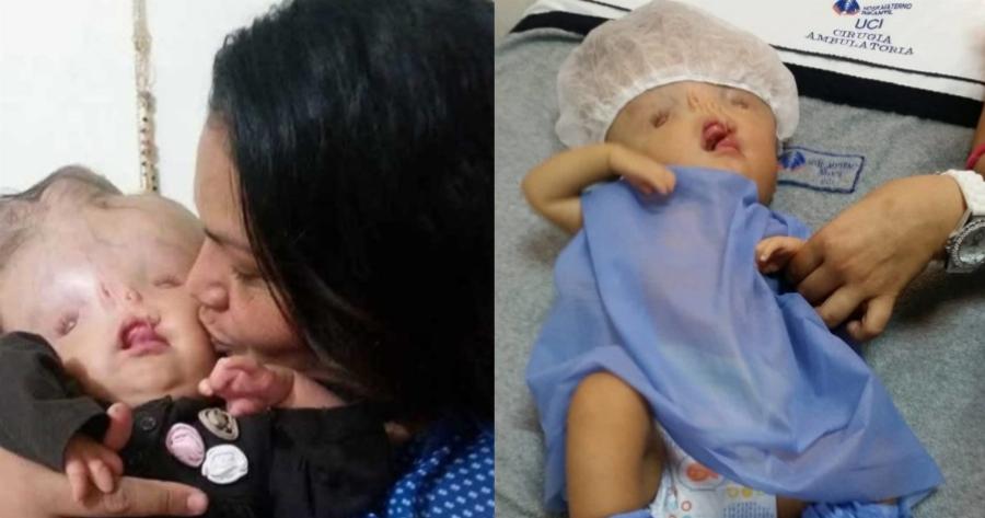 Μια μητέρα συγκινεί: «Δεν είναι εξωγήινος το παιδί μου, είναι μία πραγματική μαχήτρια»