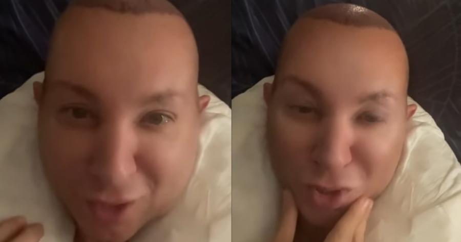 «Μπρος στα κάλλη τι είναι ο πόνος»: Σούσουρο με τη νέα εικόνα του Βασίλειου Κωστέτσου, η παραμόρφωση μετά από επέμβαση