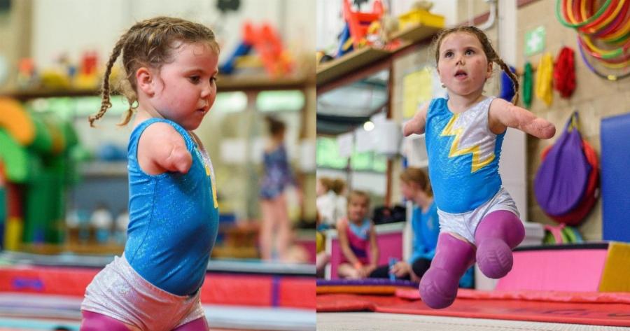 Συγκινεί η μικρή μαχήτρια: Δεν το έβαλε κάτω η 7χρονη που έχασε τα άκρα της από μηνιγγίτιδα, κατέκτησε χρυσό μετάλλιο στην ενόργανη