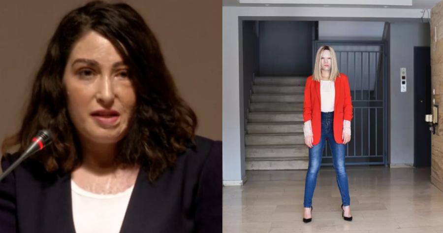 Σπουδαία Ιωάννα Παλιοσπύρου: Ιδρύει ίδρυμα και η ανακοίνωση θα γίνει στο σημείο που δέχτηκε την επίθεση με βιτριόλι