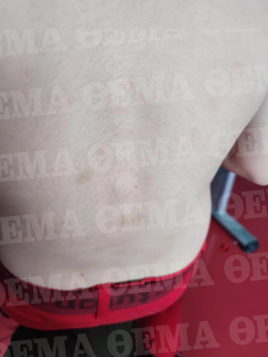 Ταξίδια εργασίας στη Κιβωτό του Κόσμου: Νέα καταγγελία αποκαλύπτει πως έστελναν παιδιά να μαζέψουν ελιές στη Μυτιλήνη