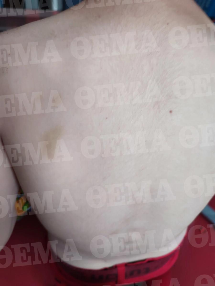 Ταξίδια εργασίας στη Κιβωτό του Κόσμου: Νέα καταγγελία αποκαλύπτει πως έστελναν παιδιά να μαζέψουν ελιές στη Μυτιλήνη