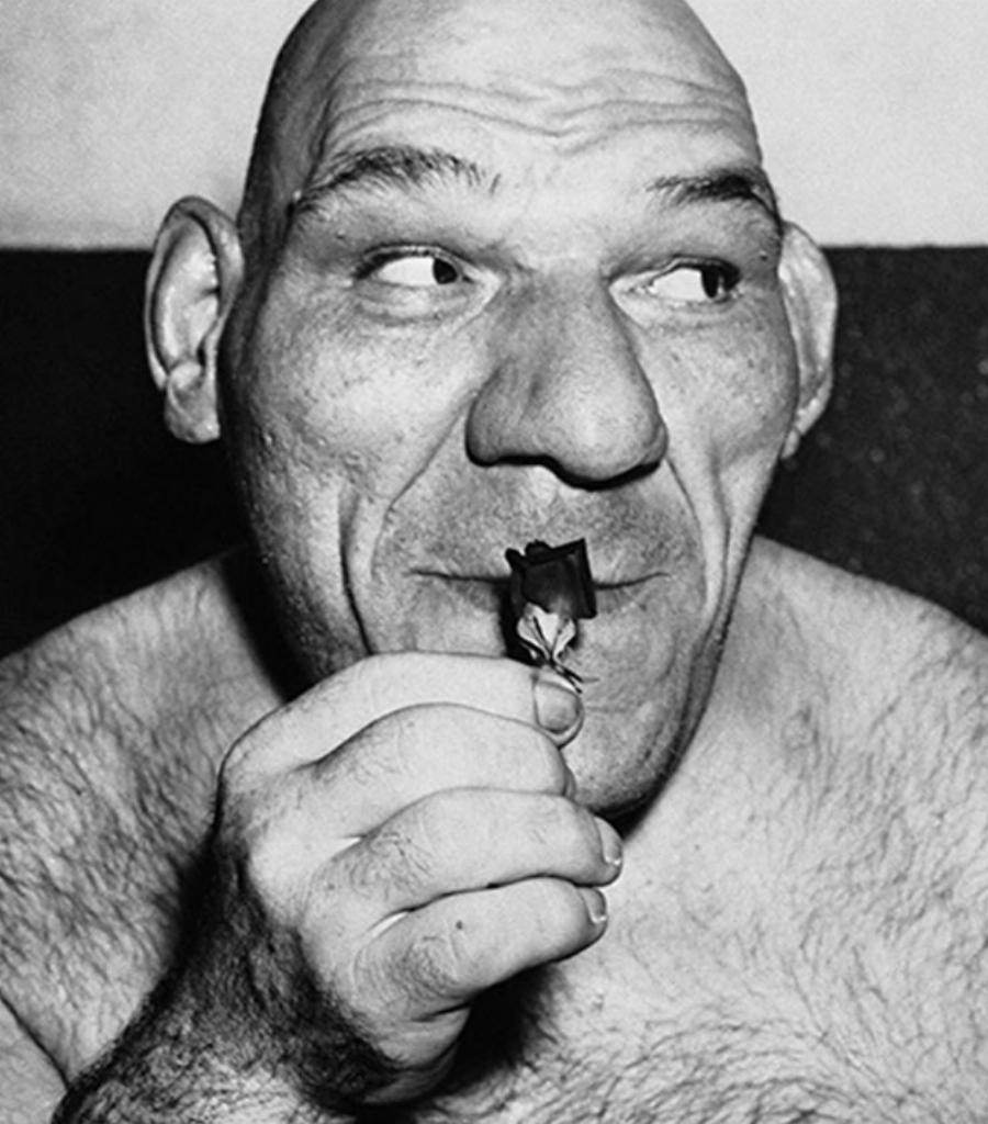 Ο πραγματικός “Σρεκ”: Η ιστορία του καρδιοκατακτητή, η σπάνια ασθένεια, η παραμόρφωση και η ταινία κινουμένων σχεδίων