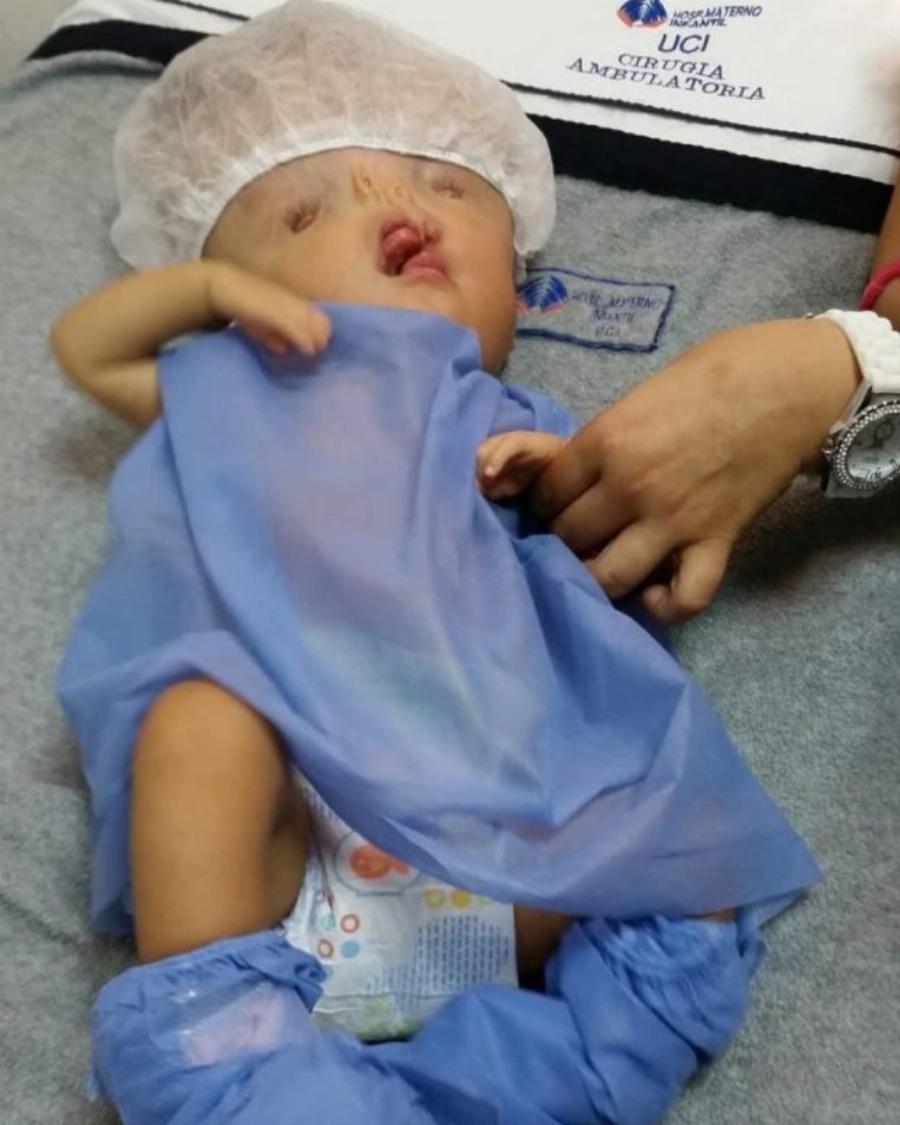 Μια μητέρα συγκινεί: «Δεν είναι εξωγήινος το παιδί μου, είναι μία πραγματική μαχήτρια»