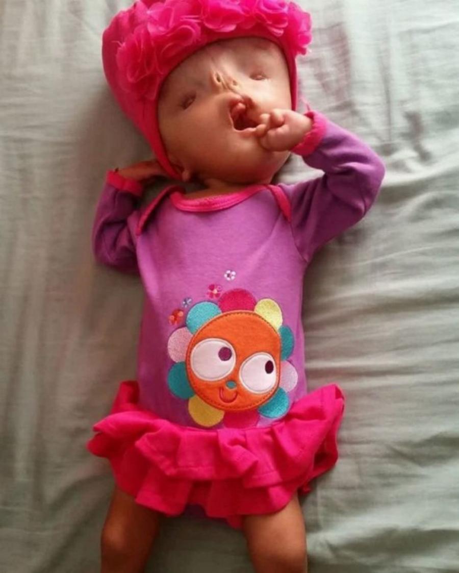 Μια μητέρα συγκινεί: «Δεν είναι εξωγήινος το παιδί μου, είναι μία πραγματική μαχήτρια»