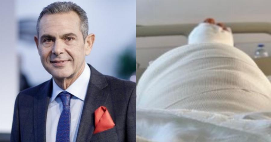 Ανησυχία για την υγεία του Πάνου Καμμένου: Σε αναπηρικό καροτσάκι μετά το τροχαίο
