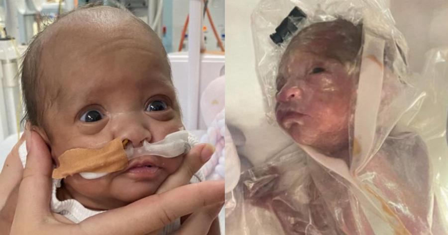 Αληθινή Ιστορία: «Μόνο εγώ πίστευα ότι το μικροσκοπικό προωράκι μου θα ζήσει και είχα δίκιο»