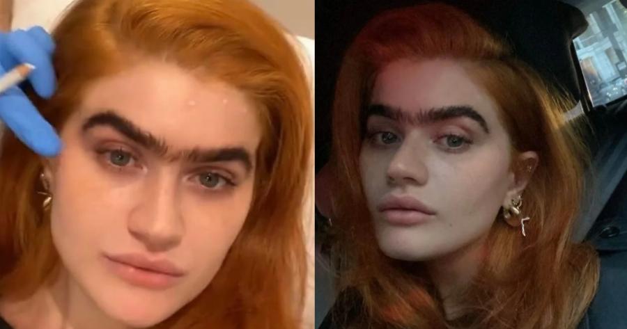 «Πείτε με “ψεύτικη” όσο θέλετε»: Η Σοφία Χατζηπαντελή ανέβασε φωτογραφίες μετά το μπότοξ