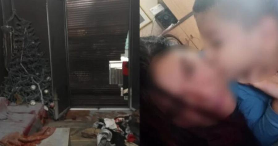 «Άγγελέ μου σήκω, η μάνα είναι εδώ»: Τσακίζει κόκαλα η μάνα του 5χρονου που χαροπαλεύει μετά τη φωτιά στο σπίτι του