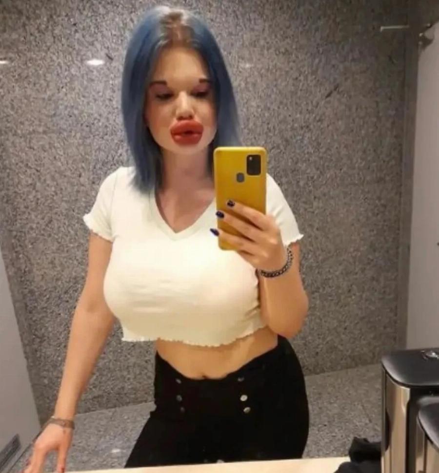 Ήθελε να μοιάζει με «κούκλα Barbie»: Από 19 ετών δεν έχει σταματήσει τις πλαστικές – «Πάντα γυρίζουν για να με κοιτάξουν»