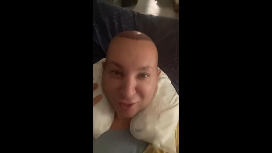 «Μπρος στα κάλλη τι είναι ο πόνος»: Σούσουρο με τη νέα εικόνα του Βασίλειου Κωστέτσου, η παραμόρφωση μετά από επέμβαση