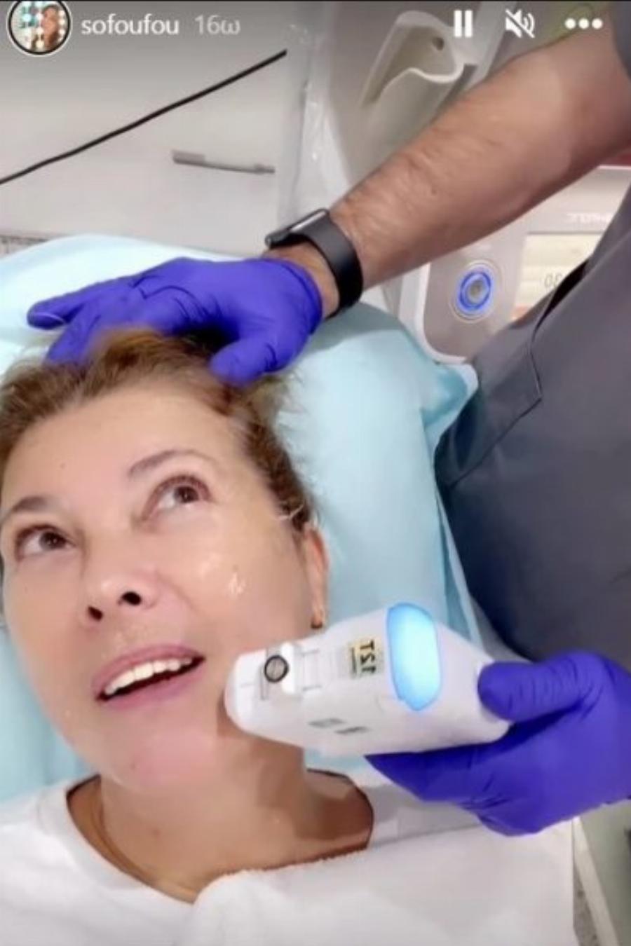 Ακομπλεξάριστη η Σοφία Αλιμπέρτη: Έκανε μη χειρουργικό λίφτινγκ προσώπου και έδειξε τη διαδικασία