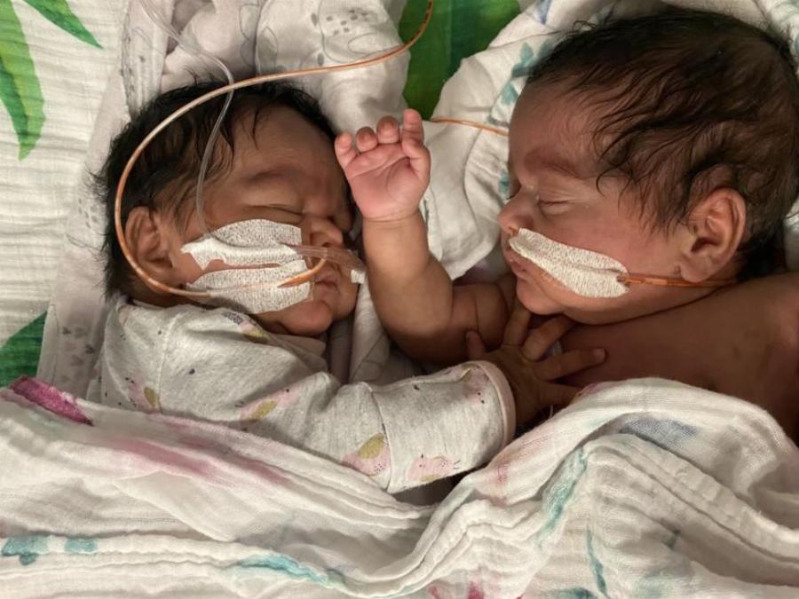 Το θαύμα των Χριστουγέννων: Γενναία διδυμάκια πάλεψαν με σήψη και μηνιγγίτιδα, νίκησαν και η ιστορία τους συγκινεί