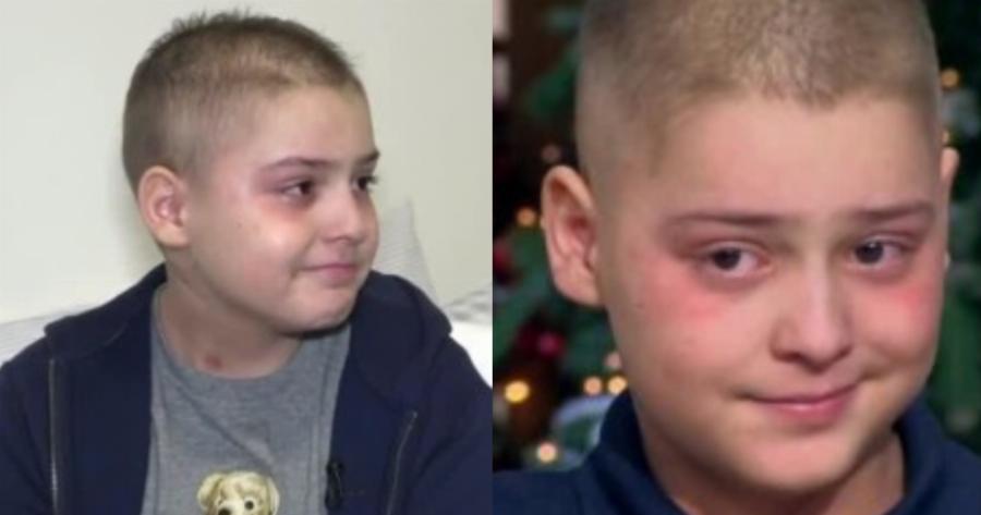 Ρίγη συγκίνησης με τον μικρό μαχητή: Ο 11χρονος Θοδωρής δίνει μάχη με τον καρκίνο και δώρισε το επίδομα του σε άλλα παιδάκια που έχουν ανάγκη