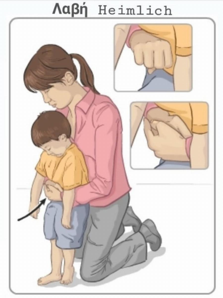 Πώς θα σώσετε κάποιον που πνίγεται από τροφή: Η λαβή Heimlich και οι κινήσεις που πρέπει να γνωρίζετε