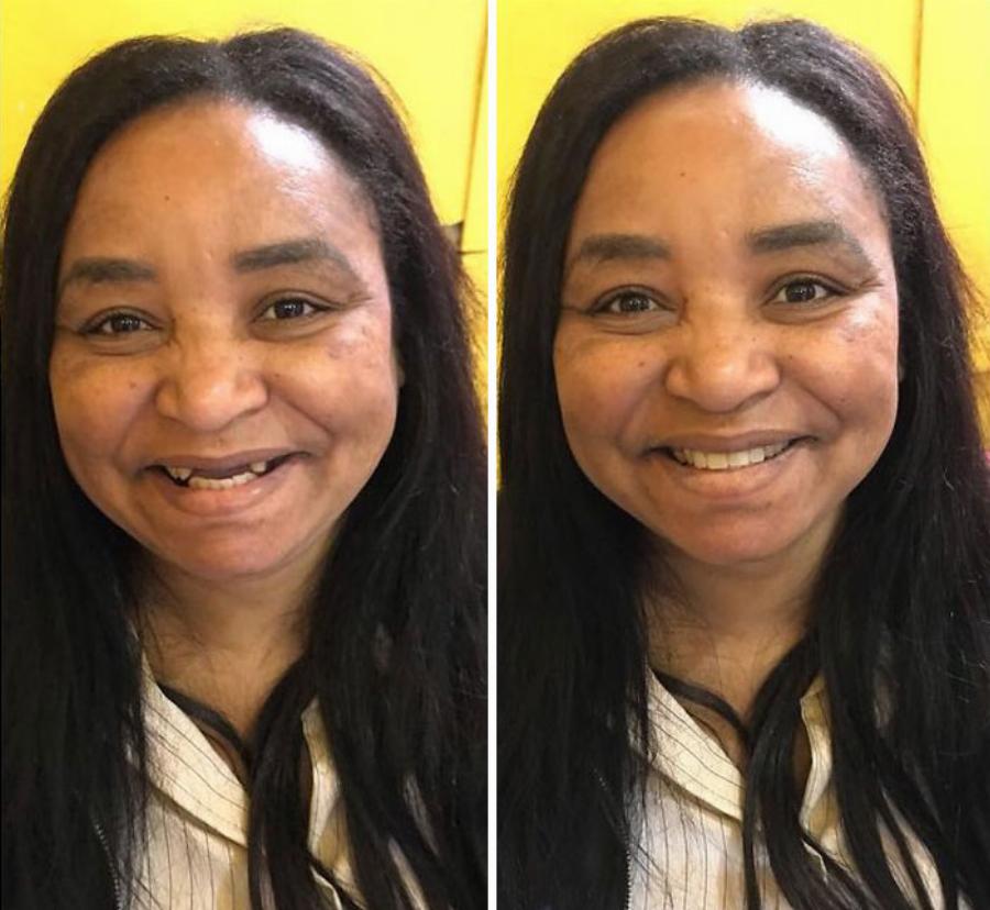 Μεγαλείο ψυχής από οδοντίατρο: Φτιάχνει δωρεάν τα δόντια φτωχών ανθρώπων και τα χαμόγελα τους μοιράζουν ευτυχία