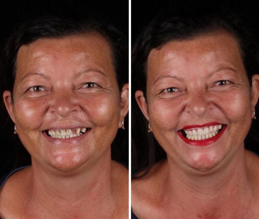 Μεγαλείο ψυχής από οδοντίατρο: Φτιάχνει δωρεάν τα δόντια φτωχών ανθρώπων και τα χαμόγελα τους μοιράζουν ευτυχία