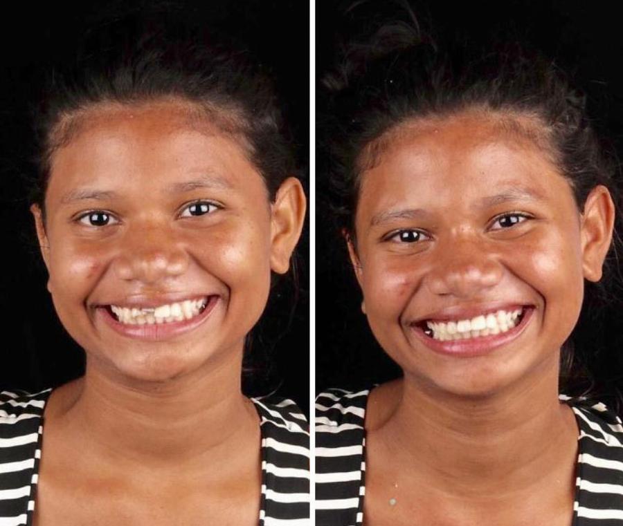 Μεγαλείο ψυχής από οδοντίατρο: Φτιάχνει δωρεάν τα δόντια φτωχών ανθρώπων και τα χαμόγελα τους μοιράζουν ευτυχία