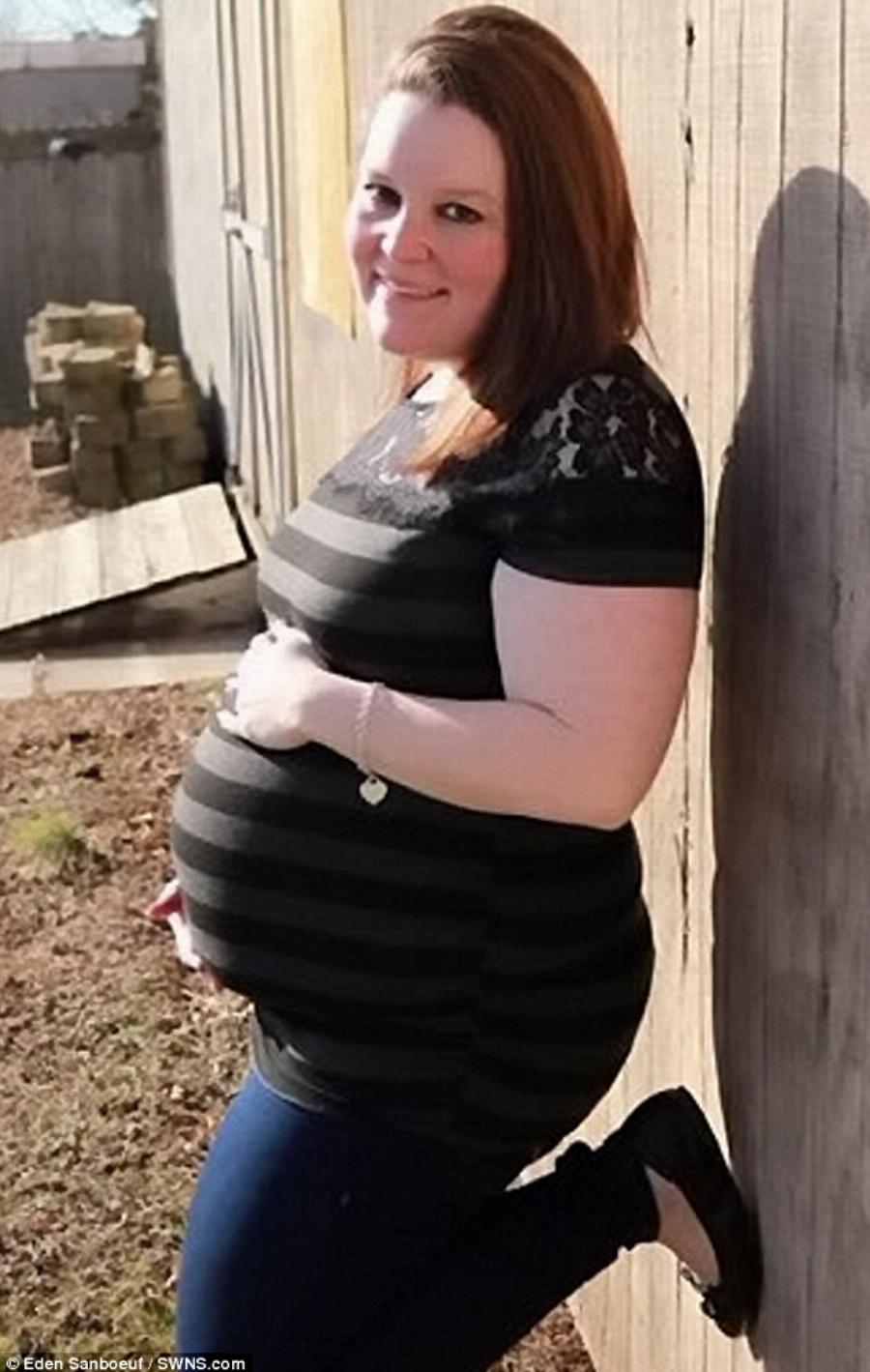 Κανείς δεν πίστευε ότι θα τα καταφέρει: Στον γάμο δεν χωρούσε στο νυφικό της, αποφάσισε να αδυνατίσει και έχασε 80 κιλά