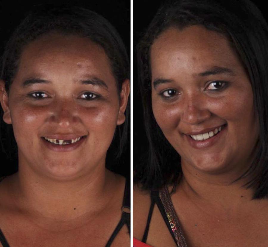 Μεγαλείο ψυχής από οδοντίατρο: Φτιάχνει δωρεάν τα δόντια φτωχών ανθρώπων και τα χαμόγελα τους μοιράζουν ευτυχία