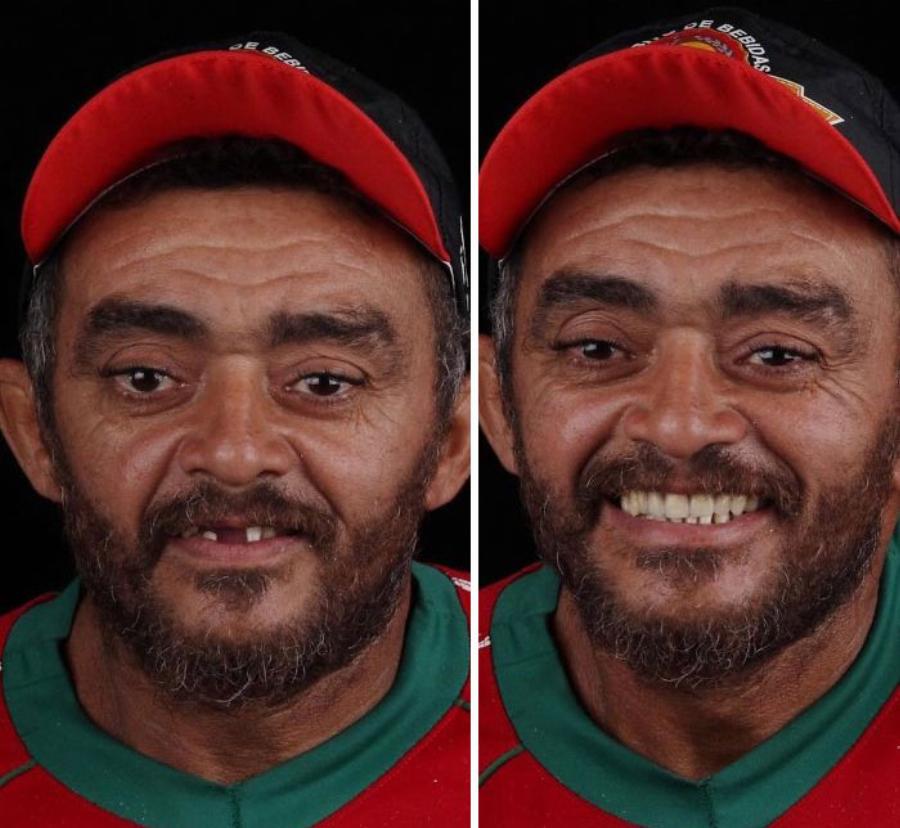 Μεγαλείο ψυχής από οδοντίατρο: Φτιάχνει δωρεάν τα δόντια φτωχών ανθρώπων και τα χαμόγελα τους μοιράζουν ευτυχία