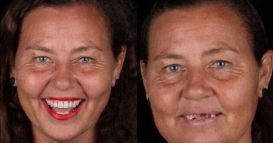 Μεγαλείο ψυχής από οδοντίατρο: Φτιάχνει δωρεάν τα δόντια φτωχών ανθρώπων και τα χαμόγελα τους μοιράζουν ευτυχία