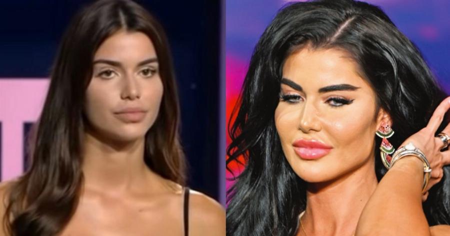 Η Ιωάννα Μπέλλα για πλαστικές επεμβάσεις: «Δείτε, μια επέμβαση έχω κάνει στο στήθος μου»