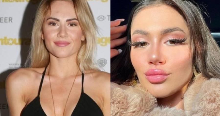 «Πώς έγινες έτσι;»: Το νέο πρόσωπο της Έλενας Τσαγκρινού, τα αρνητικά σχόλια για τις αισθητικές παρεμβάσεις και η απάντηση