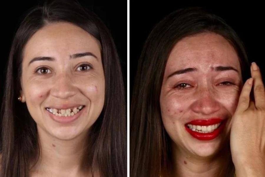 Μεγαλείο ψυχής από οδοντίατρο: Φτιάχνει δωρεάν τα δόντια φτωχών ανθρώπων και τα χαμόγελα τους μοιράζουν ευτυχία