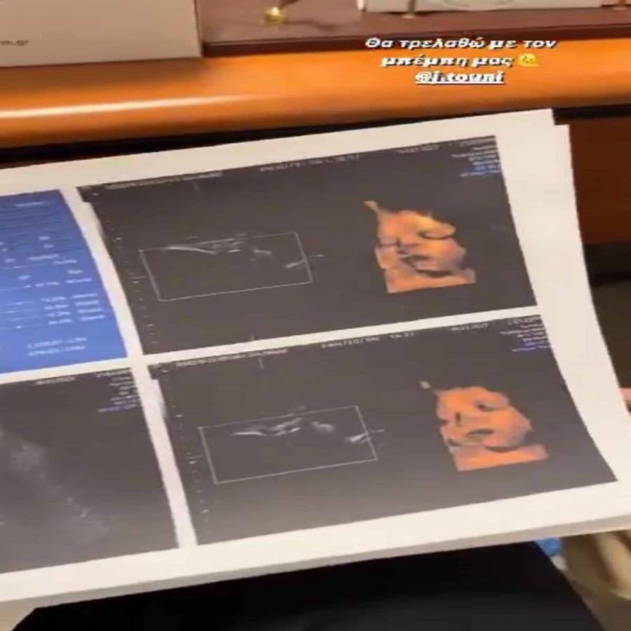 Πήρε το χαμόγελο της Ιωάννας Τούνη: Η instagrammer έδειξε για πρώτη φορά το πρόσωπο του μωρού της