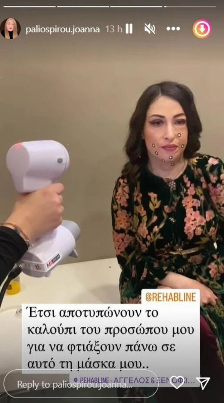 «Έτσι «τυπώνουν» το πρόσωπο μου»: Η Ιωάννα Παλιοσπύρου μας δείχνει για πρώτη φορά πως κάνουν το καλούπι για τις μάσκες της