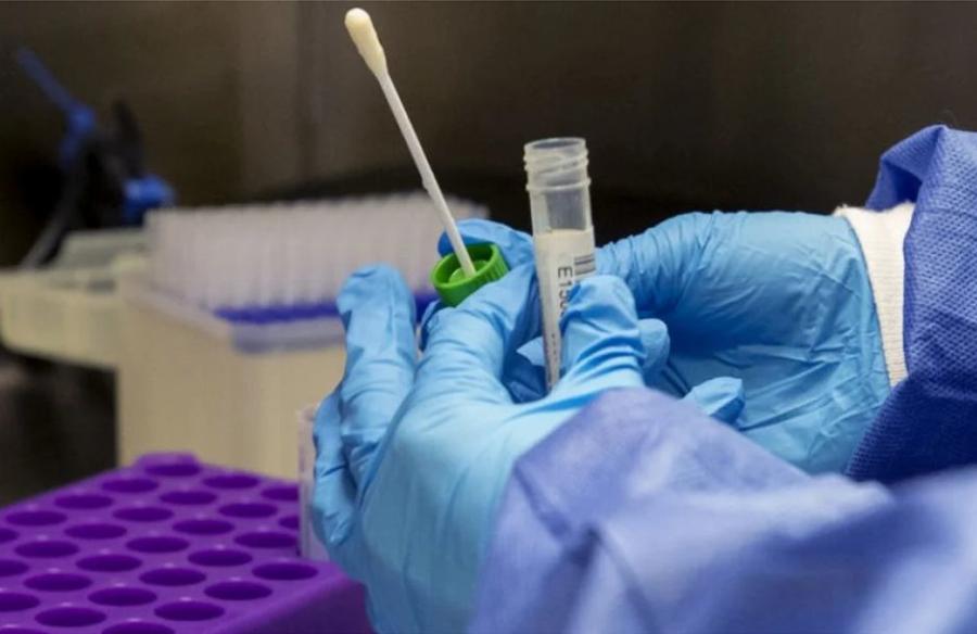 Καμία σχέση με την Όμικρον: Τα 4 “ύπουλα” συμπτώματα της μετάλλαξης “Κράκεν” που δείχνουν ότι κόλλησες