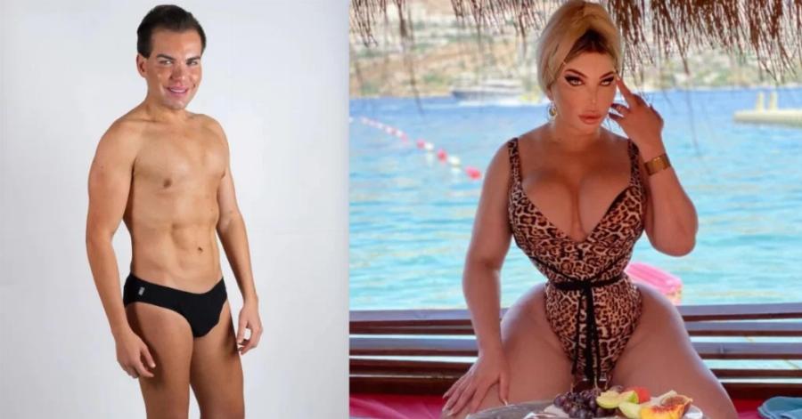 Άντρας έκανε 103 πλαστικές, έγινε γυναίκα, έχασε την όσφρυσή της και σήμερα μοιάζει με κούκλα από ταινία… τρόμου