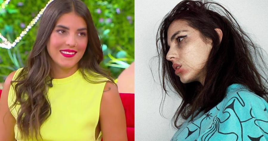 «Περιμένω την ημέρα που η θεραπεία θα πιάσει τόπο»: Το πρόβλημα υγείας της Άννας Μαρίας Βέλλη